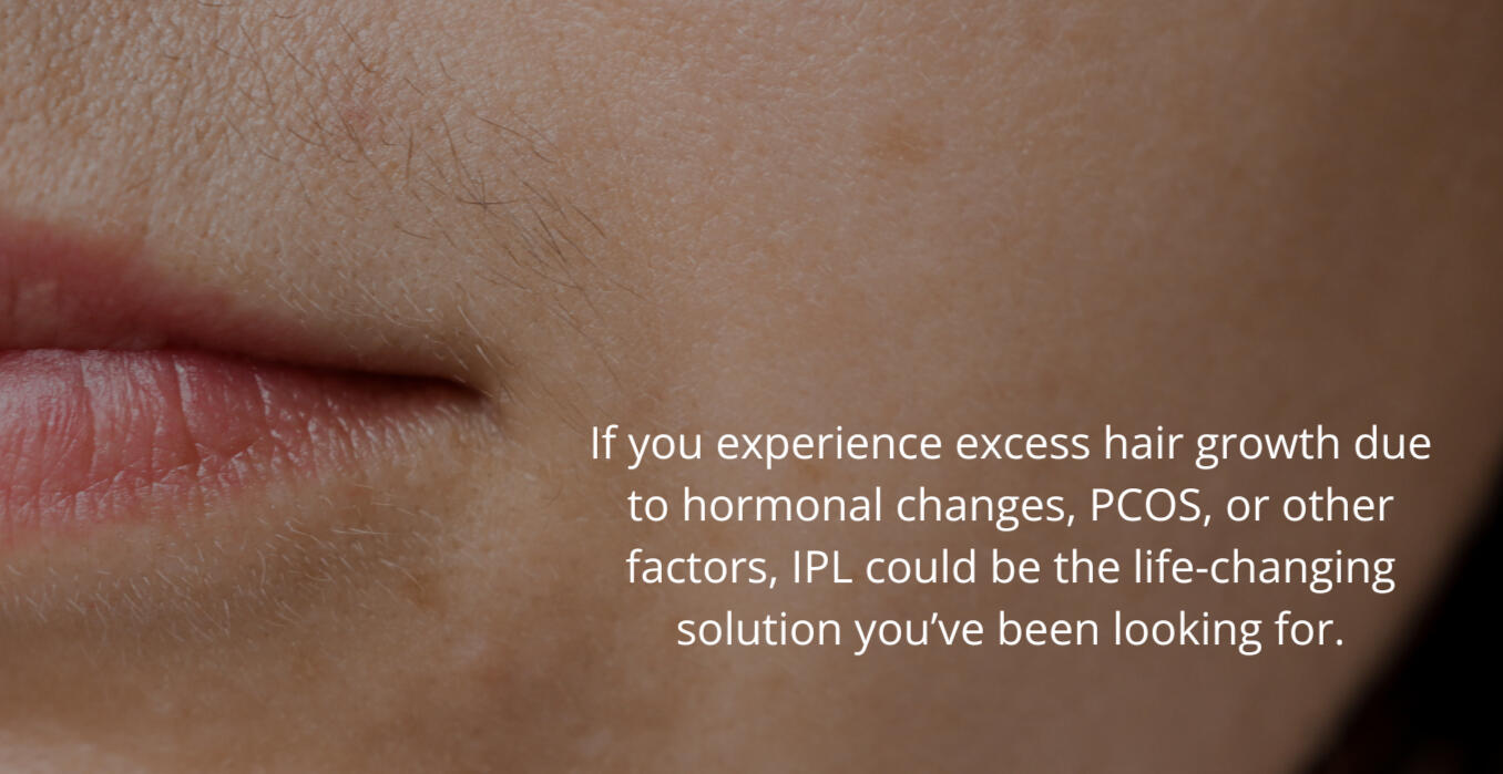 Unwanted hair growth on upper lip